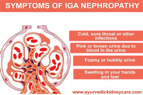 iga nephropathy life expectancy